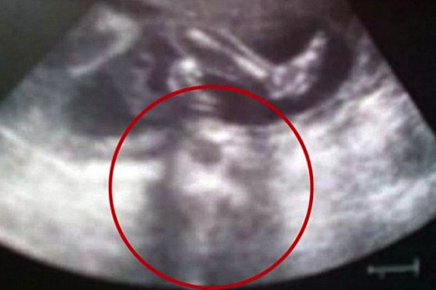 태아 초음파 사진에 나타난 예수 얼굴 이미지가 화제가 되고 있다.