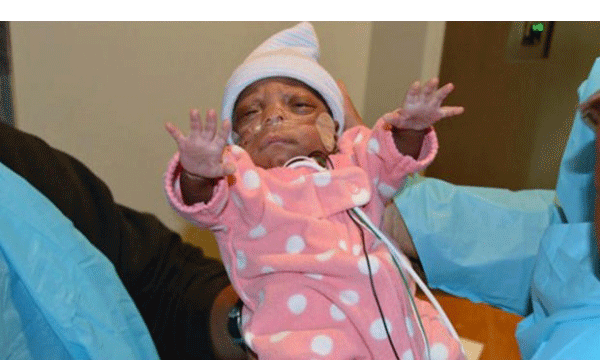 가장 작은 신생아 엘라야 페이스